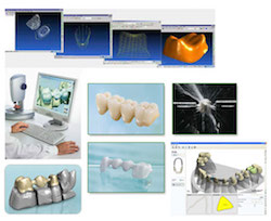 3D технологии для идеального протезирования (CAD/CAM) 