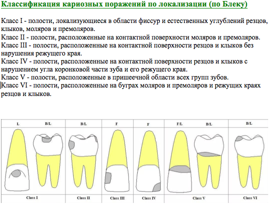 Классификация видов кариеса | Статьи