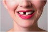 14 шокирующих вещей, которые вам необходимо знать о здоровье зубов