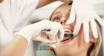 вырывание зуба